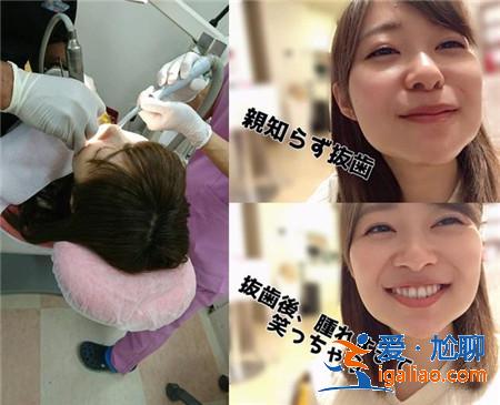 AKB48指原莉乃缺席握手會 連拔四顆智齒變國字臉