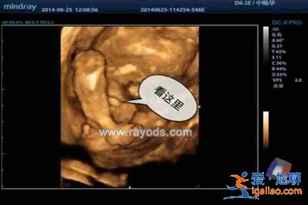 正規(guī)助孕包性別，第一助孕資訊？