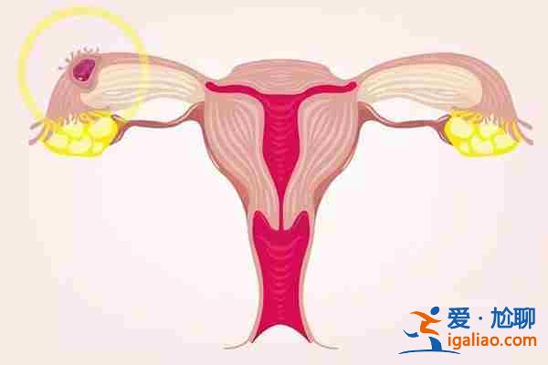 國內代生孩子價格_供卵自懷？