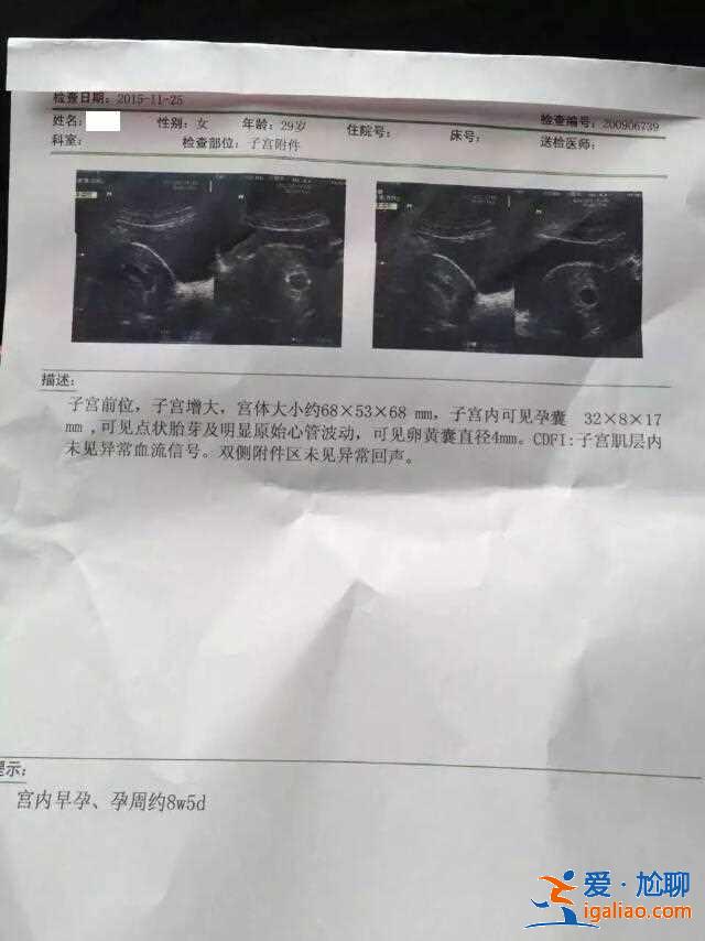 代懷小孩哪家優惠，備孕期間吃鹿胎膏有助孕效果嗎？
