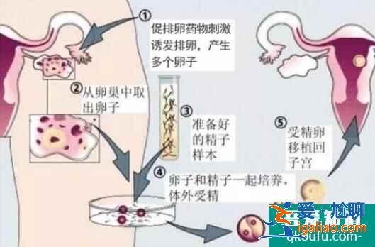 人工授精多次失敗后還可以做試管嬰兒嗎?? 人工授精多次失敗后還可以做試管嬰兒嗎??