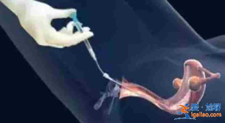 珠海助孕中心,17年行業(yè)經(jīng)驗(yàn)? 珠海助孕中心,17年行業(yè)經(jīng)驗(yàn)?