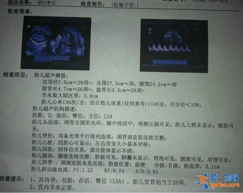 星星助孕，人生幸福時光就此開始？