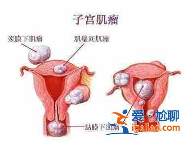 福州代生小孩? 福州代生小孩?