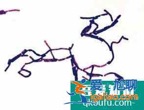 革蘭氏染色的步驟及結(jié)果對照？