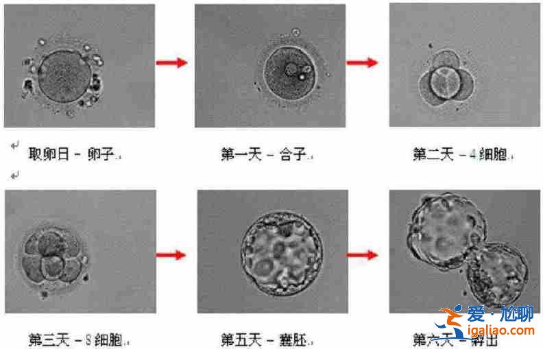 解說俄羅斯同性試管嬰兒能做龍鳳胎嗎_成功率高？