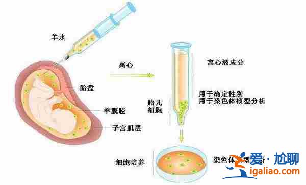 蘭州代生孩子包成功？