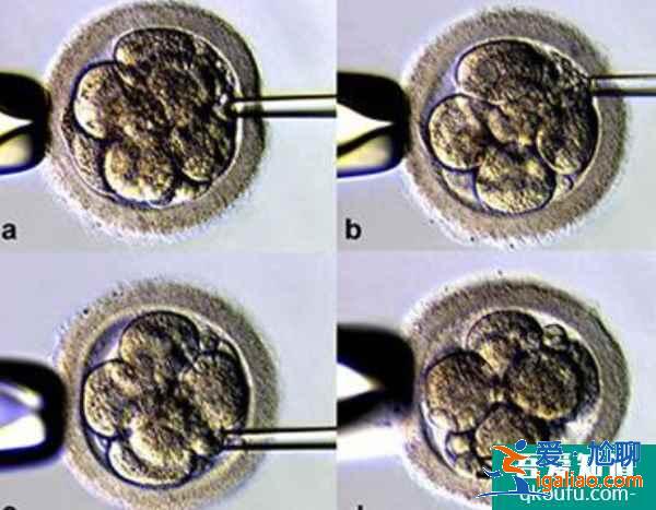 做試管嬰兒有哪些優勢?為什么高端人群大都傾向于此?? 做試管嬰兒有哪些優勢?為什么高端人群大都傾向于此??