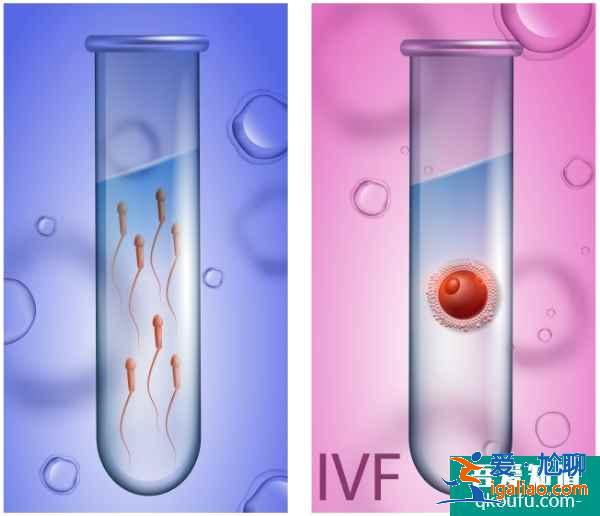 去做試管嬰兒，具體步驟是什么?？