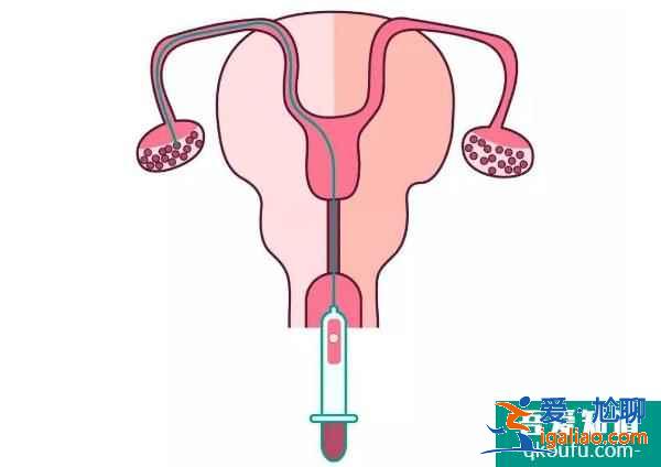 試管嬰兒促排卵與乳腺癌之間到底有沒有關系？？