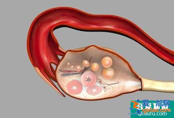 試管嬰兒促排卵與乳腺癌之間到底有沒有關系？？