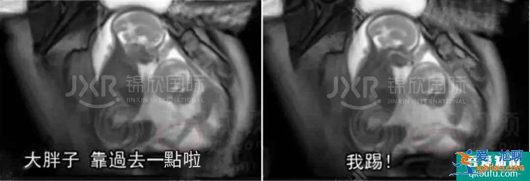 試管專家告訴你：如何懷雙胞胎，你懷雙胎的幾率高嗎？？