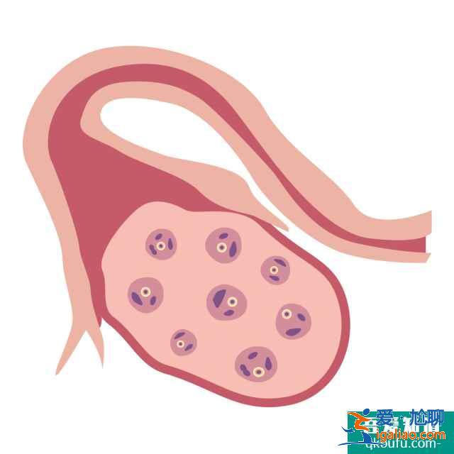 泌乳素過高去泰國做試管嬰兒，從三個方面保障成功率？