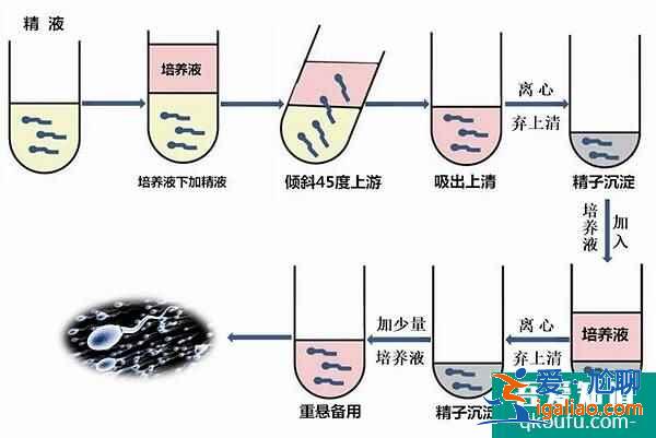 試管嬰兒專家：赴美IVF前遠離輻射、提高精卵質量？