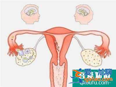 高齡女性做試管也很難能成功嗎?醫(yī)生分析:年齡是最大的障礙? 高齡女性做試管也很難能成功嗎?醫(yī)生分析:年齡是最大的障礙?