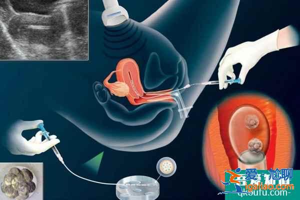試管嬰兒專家:從4個方面確保IVF的安全性? 試管嬰兒專家:從4個方面確保IVF的安全性?