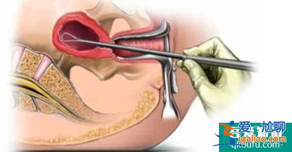 子宮內膜不典型增生可以做泰國試管嬰兒嗎，成功率高嗎？？