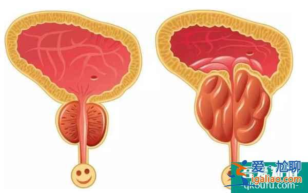 泰國試管嬰兒專家如何助繼發性不孕客人好孕？？