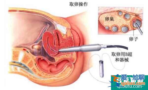 泰國試管嬰兒周期安全性高，主要體現在以下三個方面？