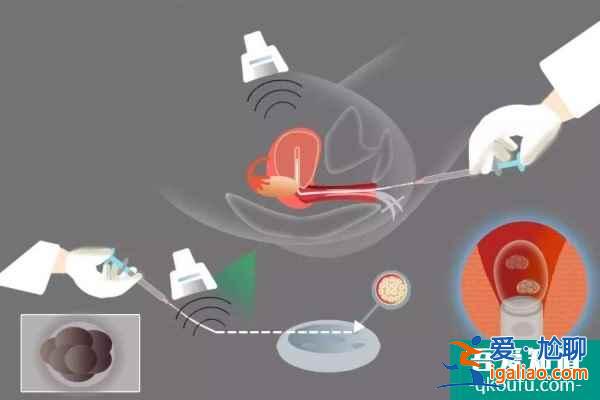 女性大于35歲，做第三代試管嬰兒成功率高嗎？？