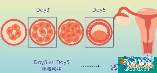 試管嬰兒:用一個試管周期成就一生求子心愿? 試管嬰兒:用一個試管周期成就一生求子心愿?