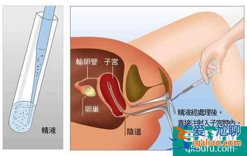 人工授精后需要注意什么？？