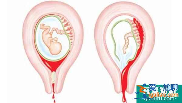 婦科炎癥影響取卵嗎?做試管嬰兒前如何調(diào)養(yǎng)身體?? 婦科炎癥影響取卵嗎?做試管嬰兒前如何調(diào)養(yǎng)身體??
