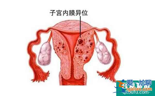 通過試管嬰兒生健康寶寶的基礎之良好子宮內環境？