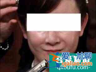 有些女明星為啥越做醫(yī)美越衰老？