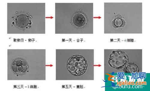 試管嬰兒胚胎評級與成功率之間有什么關系？？