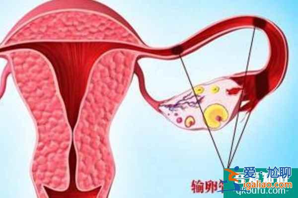 根據不同的先天性子宮畸形情況選擇試管嬰兒方案？