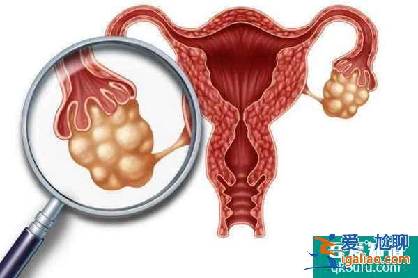 解惑：多囊卵巢和卵巢過度刺激是一回事嗎？？