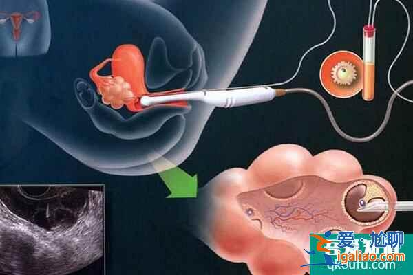 女性患有糖尿病,能赴美做試管嬰兒嗎?? 女性患有糖尿病,能赴美做試管嬰兒嗎??