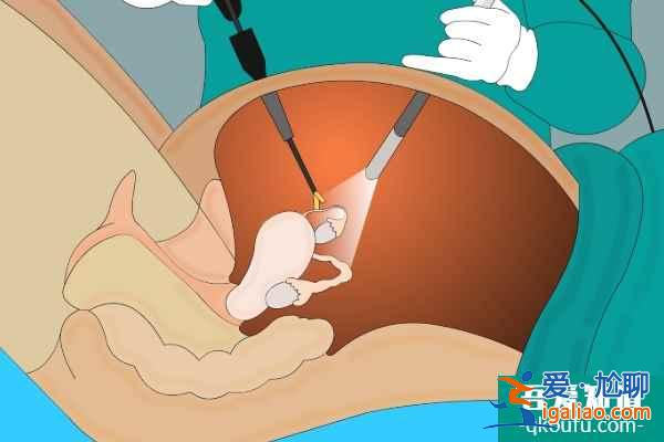 宮腔粘連子宮不好可以赴美做試管嬰兒嗎?? 宮腔粘連子宮不好可以赴美做試管嬰兒嗎??