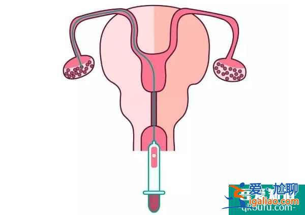 解析：試管嬰兒促排與乳腺癌之間有關系嗎?？