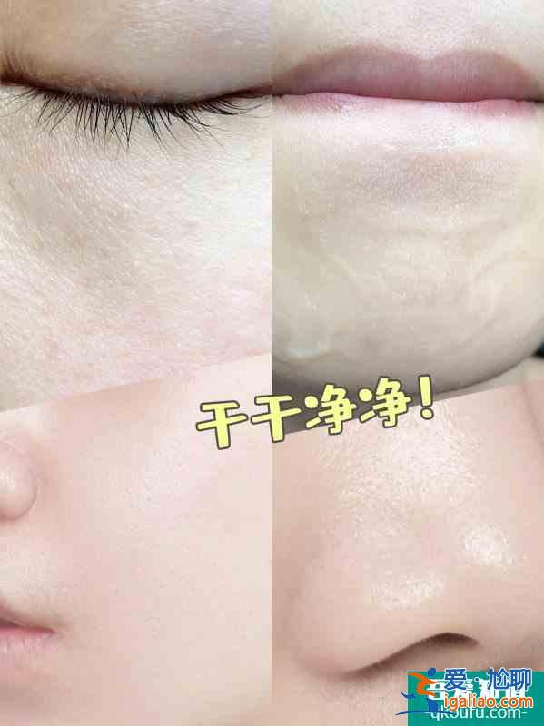 女明星的護膚方法解決了我的痘痘痘印問題！？