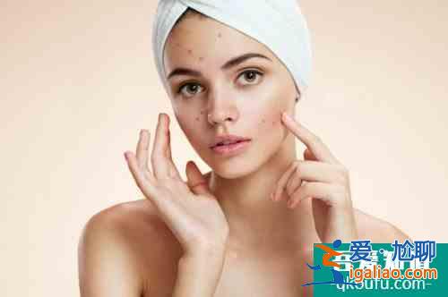 閉嘴怎么去 去閉嘴的3個小妙招? 閉嘴怎么去 去閉嘴的3個小妙招?