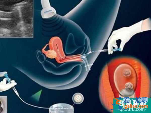 去做試管嬰兒，會出現多胞胎的情況嗎？？