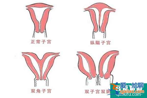 深析三個子宮異常問題？