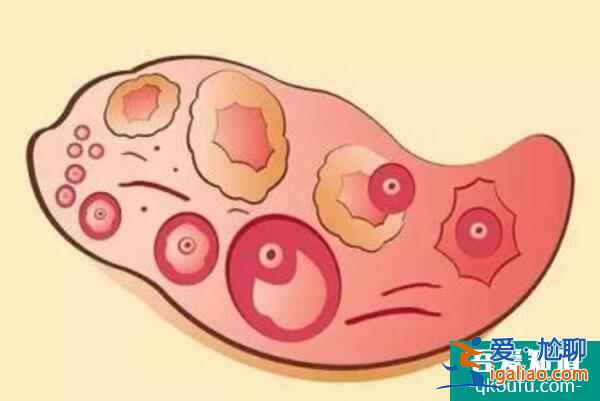 生命：赴美試管嬰兒抽血檢查項(xiàng)目及意義分析？