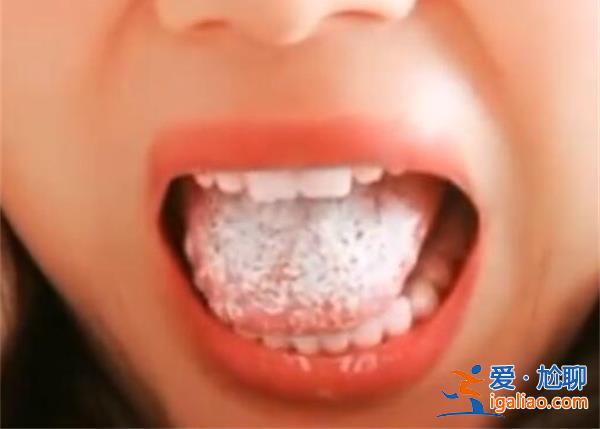 陽后舌頭會長厚白舌苔嗎? 陽后舌頭會長厚白舌苔嗎?