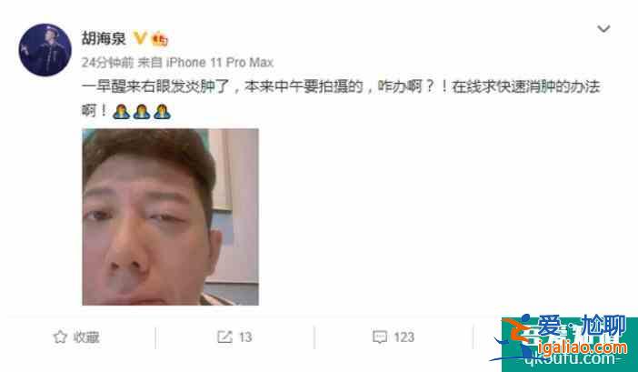胡海泉右眼發炎紅腫 吃力半睜右眼盡顯疲憊十足？