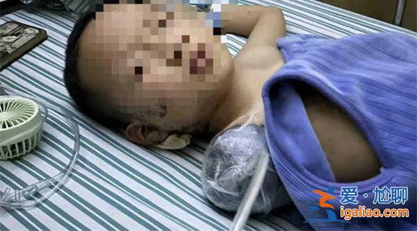 7歲男童被炮仗扎傷手臂截止，當地警方已經展開調查[警方]？