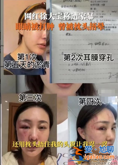 女星徐大寶要做混血試管兒 曾因家暴離婚不相信愛情 網(wǎng)友在線勸阻扎心了