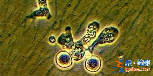 男子用自來水洗臉感染食腦蟲死亡，食腦蟲有多可怕[自來水]？