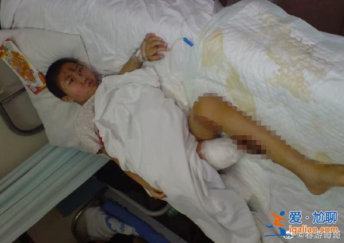 爸爸唯一一次哭是跪求醫(yī)生不要截掉我的右腿? 爸爸唯一一次哭是跪求醫(yī)生不要截掉我的右腿?