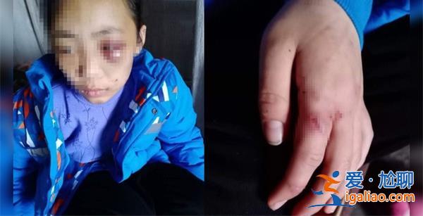 繼母涉嫌虐待繼女致殘疾，真的虐待致殘疾嗎[繼母虐待繼女]？