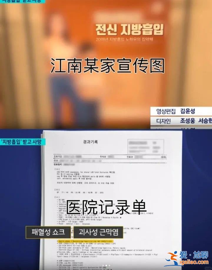 赴韓整形兩周內三次抽脂 20多歲中國女孩不幸身亡 韓國警方計劃尸檢？
