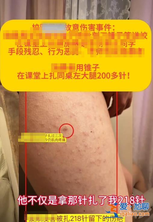 山東章丘一女生被同桌男生用錐子扎數(shù)百下？當(dāng)?shù)匾殉闪⒙?lián)合調(diào)查組？